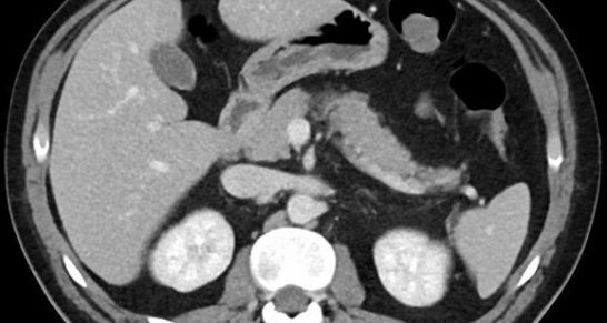 Profound Mri ארכיון Profound - MRI הפורטל הישראלי