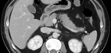 אבחון צילומי דימות