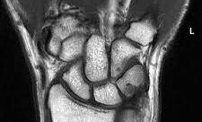 MRI שורש כף יד